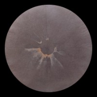 yes_We did not see filter 4